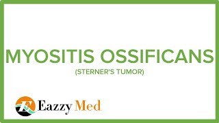 MYOSITIS OSSIFICANS STERNERS TUMOR [upl. by Chassin647]