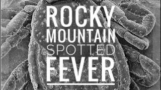 Rocky Mountain Spotted Fever Rickettsia rickettsii [upl. by Fiske]