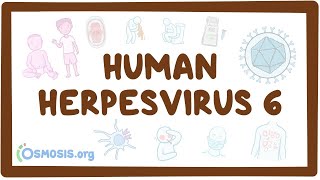 Human herpesvirus 6 Roseola  an Osmosis Preview [upl. by Ahsiuq]