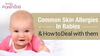 Common Skin Allergies in Babies amp How to Treat Them [upl. by Varhol]