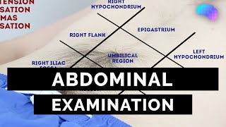 Abdominal Examination  OSCE Guide Latest  UKMLA  CPSA  PLAB 2 [upl. by Woodson803]