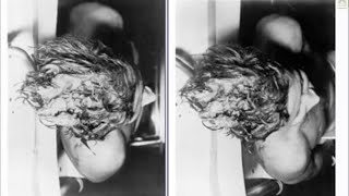 3D Photo of JFK Autopsy WARNING Graphic [upl. by Bordy]